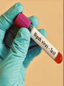 देश में कोरोना वायरस के बाद निपाह वायरस (Nipah Virus )की एंट्री,40 से 70% है मृत्यु दर, ICMR ने किया अलर्ट,