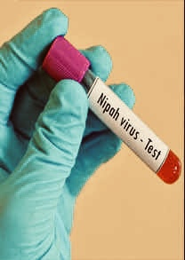 देश में कोरोना वायरस के बाद निपाह वायरस (Nipah Virus )की एंट्री,40 से 70% है मृत्यु दर, ICMR ने किया अलर्ट,