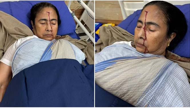 पश्चिम बंगाल की मुख्यमंत्री ममता के सिर में गहरी चोट,अस्पताल में भर्ती