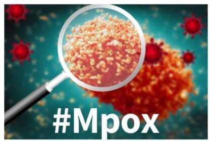 संदिग्ध एमपॉक्स मामले की जांच की जा रही है; मरीज को आइसोलेशन में रखा गया है, चिंता की कोई बात नहीं