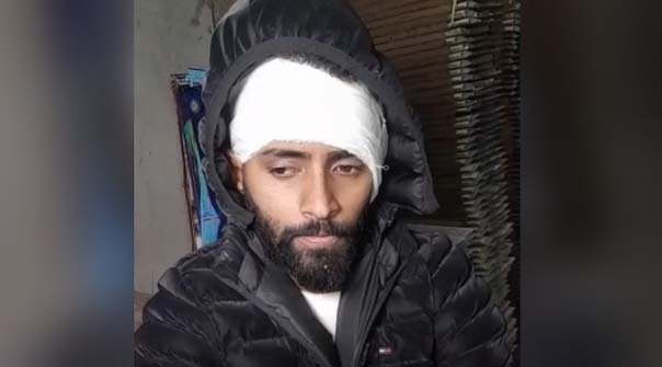 चाइनीज डोर से बाइक सवार का कान कटा : हाथ की उंगली भी जख्मी, 15 टांके लगे