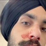 ऑस्ट्रेलिया में सिख युवक पर नस्लीय हमला, जिम के बाहर नाक तोड़ी