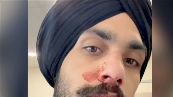 ऑस्ट्रेलिया में सिख युवक पर नस्लीय हमला, जिम के बाहर नाक तोड़ी